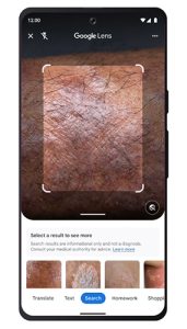 Google Lens 檢查皮膚